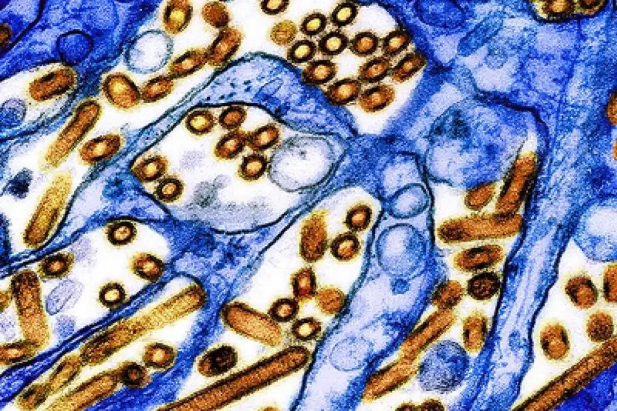H5N1